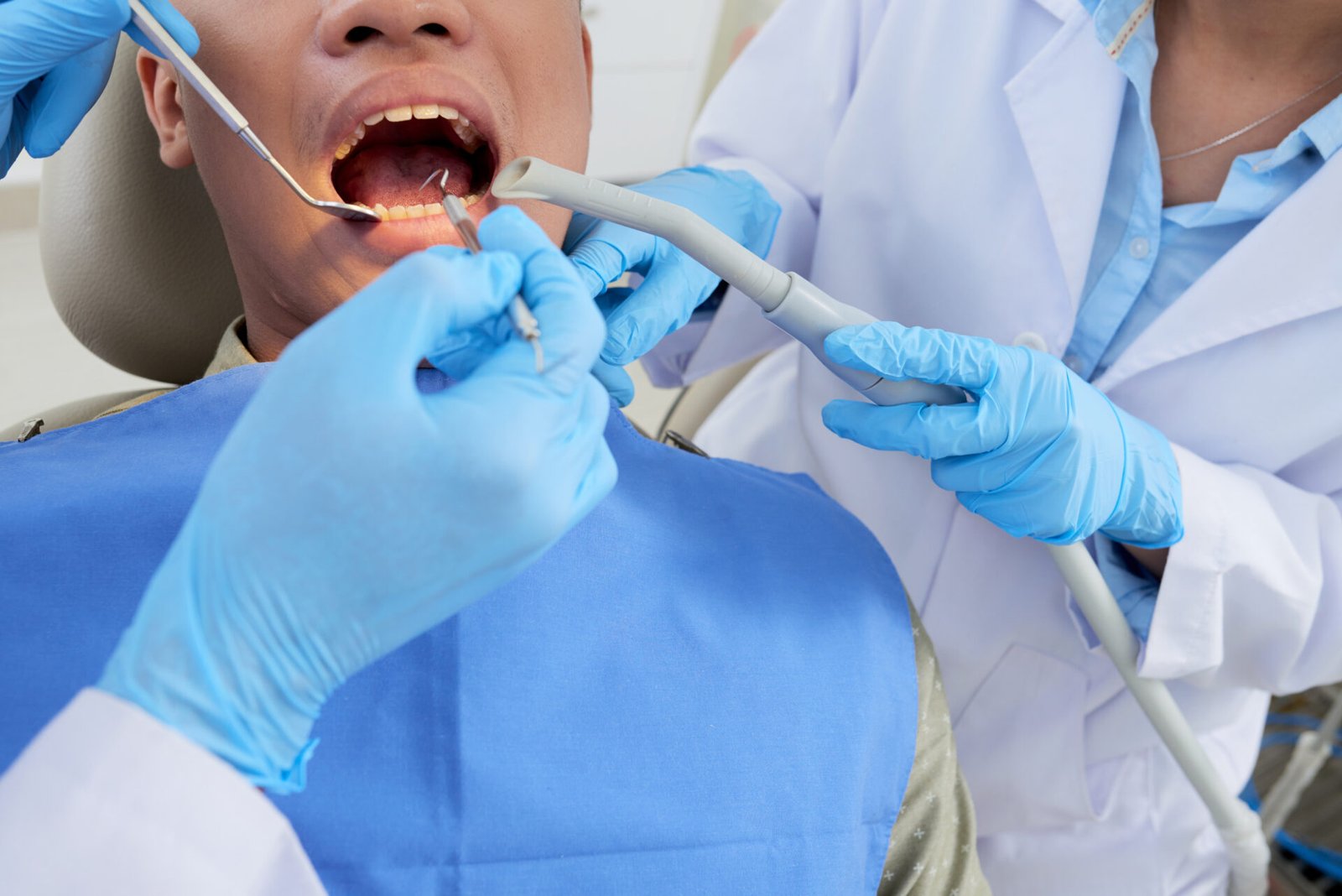 Root Canal Treatment